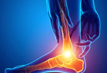 Comment réparer efficacement les tendons fibulaires?